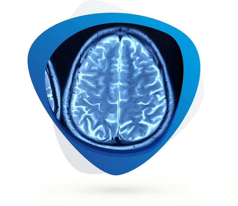 Preclinical Studies of Depression