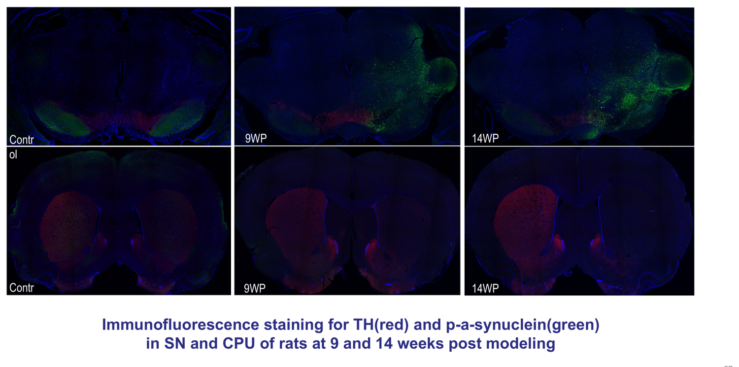 AAV-SNCA + PFF Parkinson's disease rat model — immunofluorescence staining of TH and p-alpha-synuclein