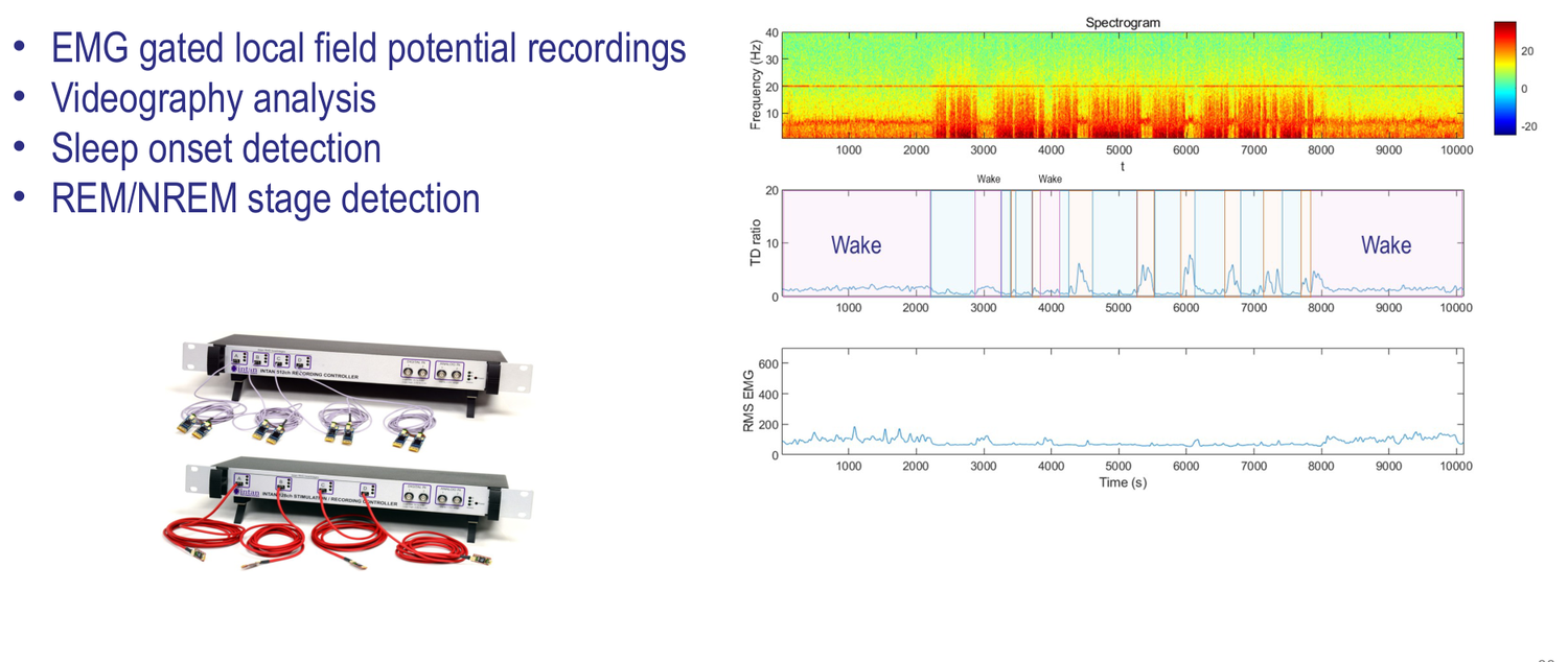 Electrophysiological analysis of sleep, insomnia and narcolepsy — polysomnography