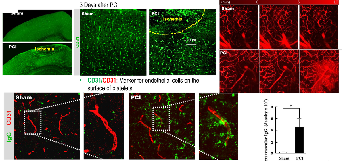 Photothrombotic stroke model in rodents — CD31 and IgG immunohistochemistry