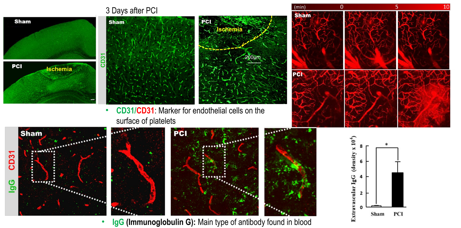 Photothrombotic stroke model in rodents — CD31 and IgG immunohistochemistry
